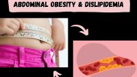 Abdominal-Obesity-and-Dislipidemia-1.jpg